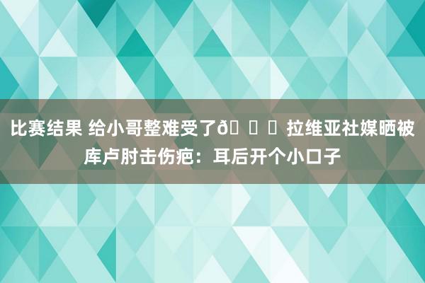 比赛结果 给小哥整难受了😅拉维亚社媒晒被库卢肘击伤疤：耳后开个小口子